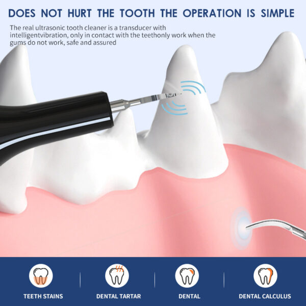Ultrasonic Pet Teeth Cleaning Device